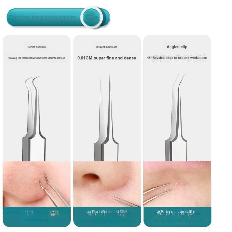 Future Maple Blackhead Removal Tool For Acne And Pimple Extraction On The Face Pimple Needle Set-2