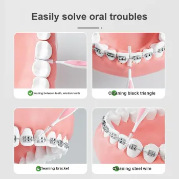 PROTEFIX Specifically For Tooth Gaps Interdental Brush Orthodontic Cleaning