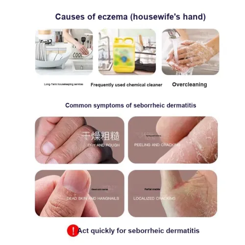 SUXIUCHENSHI Крем с гепарином натрия уменьшающий темные круги улучшающий темные области под глазами увлажняющий 30 г Упаковка