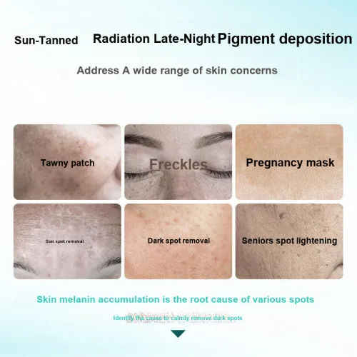 TEYI Отбеливание Удаление Темных Пятен Крем с Жемчугом Уменьшение Мелких Линей Увлажнение Укрепление Кожи Стабилизация Увлажнения