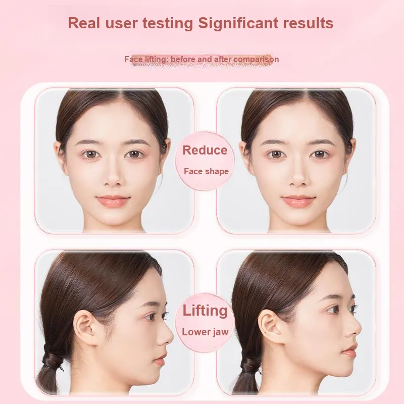 JIANMEICHUANGYAN V Shaped Face With Slimming Veneer, Firming And Lifting, Invisible Facial Contour-1