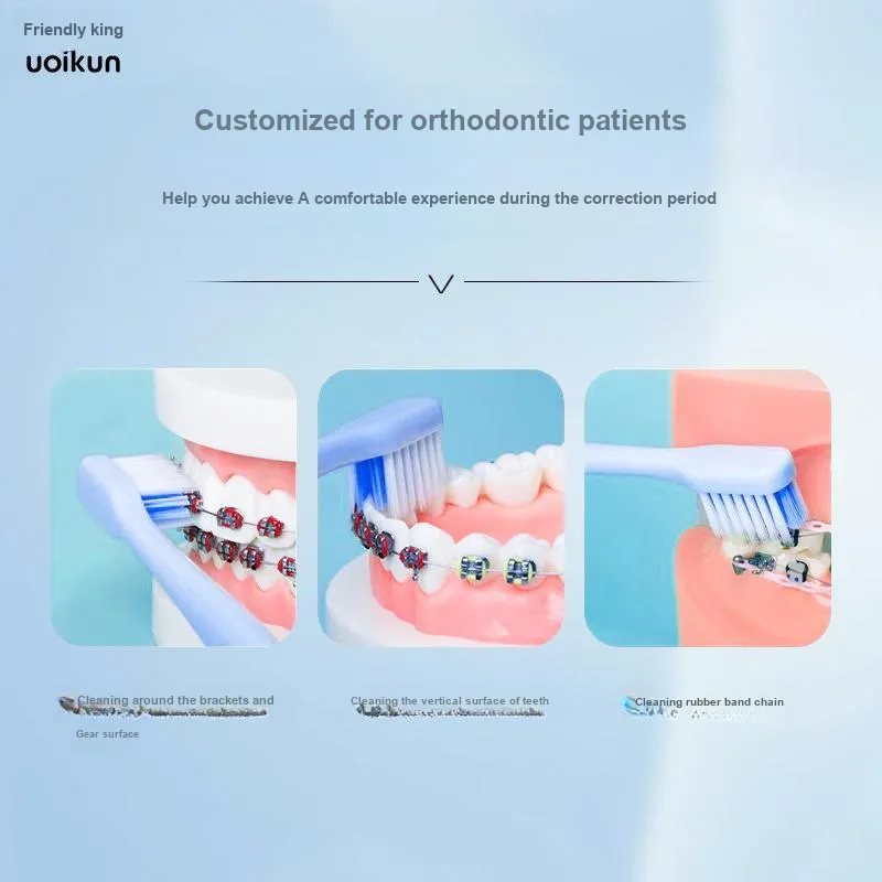 YOUYOUJUN U Shaped Orthodontics Toothbrushes Orthodontic Teeth-2
