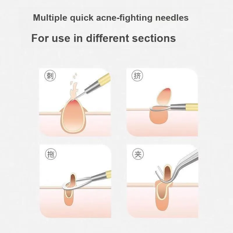 XIAOTIANLAI Pimple Extractor Blackhead Extractor Set Tools Cell Pincher Tweezers Pore Cleanser Beauty Salon 6 Pcs Set-4