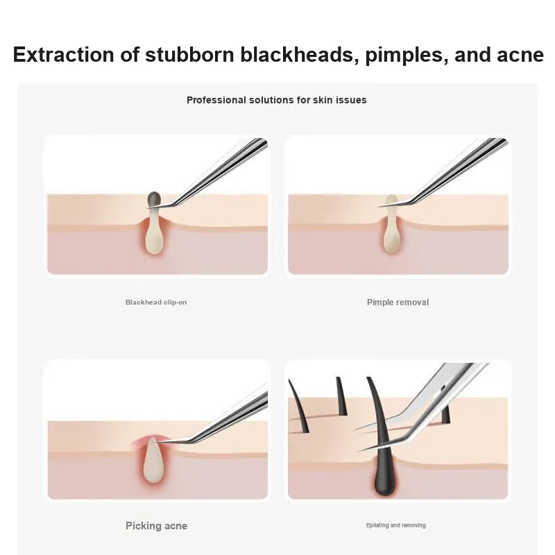 JIANYINGSHU Size 5 Ultra Slim Slant Clip Make up Tools 45° Angle Blackhead And Acne Removal-7