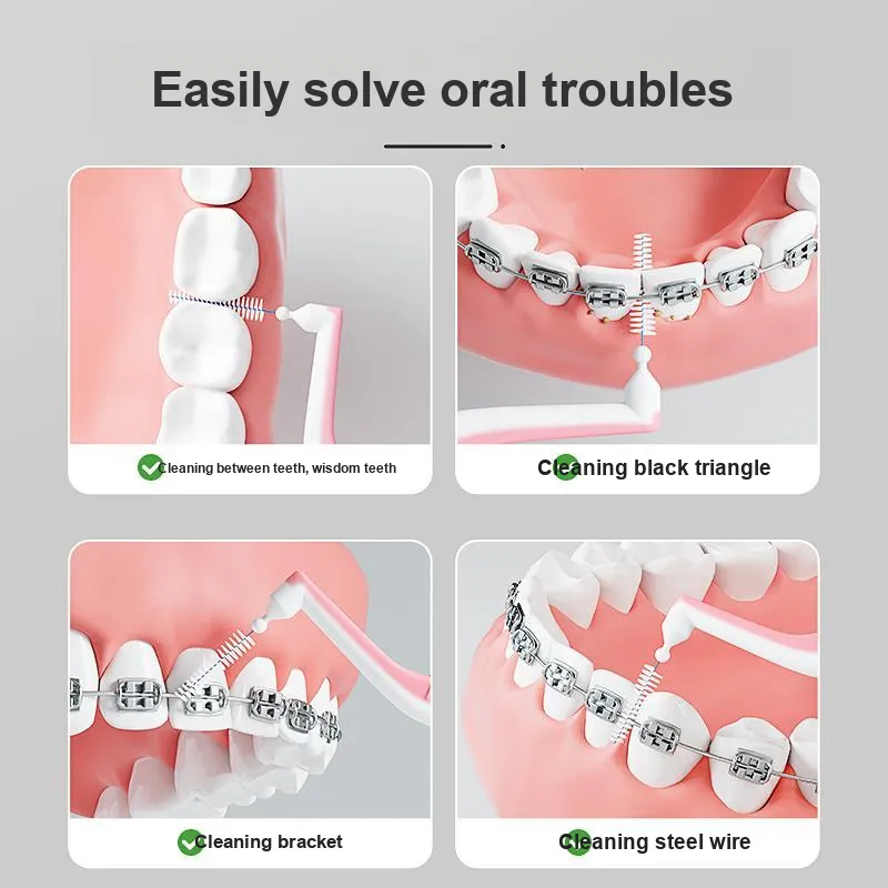 PROTEFIX Interdental Brush Dental Fissure Specialized Orthodontic Cleaning L Shaped Super Fine Soft Bristle Brush-1