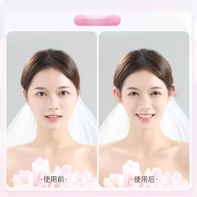 Goodgudi Elf Ear Patch Strong Support Ear, Helps To Minimize Face Size, Reusable-4