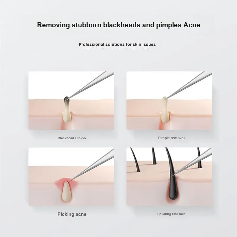 JIANYINGSHU Size 5 Ultra Sharp Straight Clip Make up Tools Blackhead Removal Needle-2