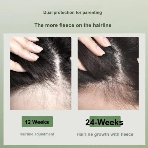 Silk From предотвращает потерю волос и фиксация шампунь растительного происхождения освежающий и контроль жирности анти-разрыв