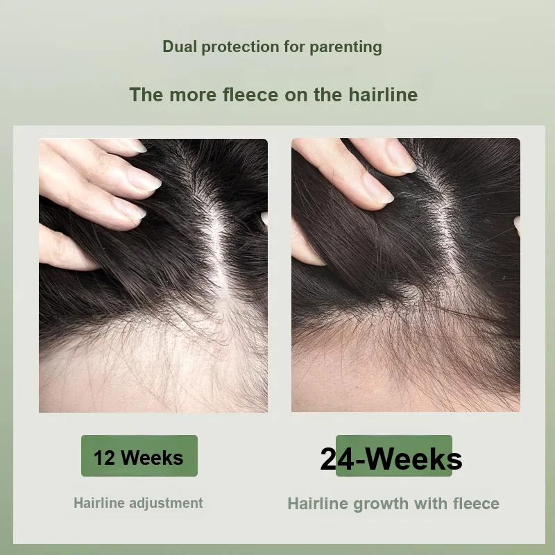 Silk From предотвращает потерю волос и фиксация шампунь растительного происхождения освежающий и контроль жирности анти-разрыв