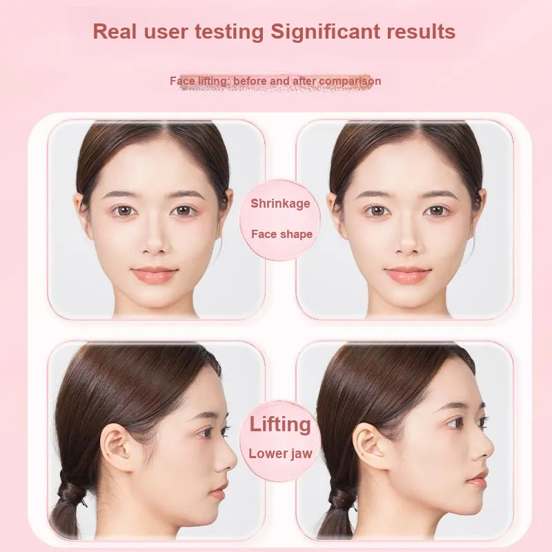 JIANMEICHUANGYAN V Shaped Face With Slimming Veneer, Firming And Lifting, Invisible Facial Contour-5